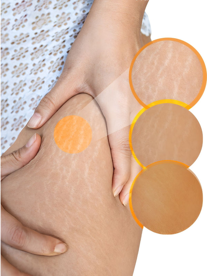 Quieres disimular estrías, venitas, celulitis o imperfecciones en la piel.